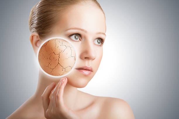 Dry Skin : These 3 Ultimate Guide and the symptoms